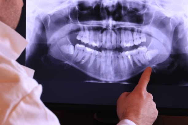 Best Emergency Denture Repair in Dolgeville, NY